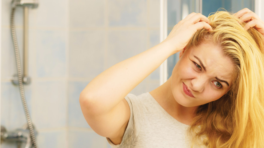 כינים: אילוסטרציה