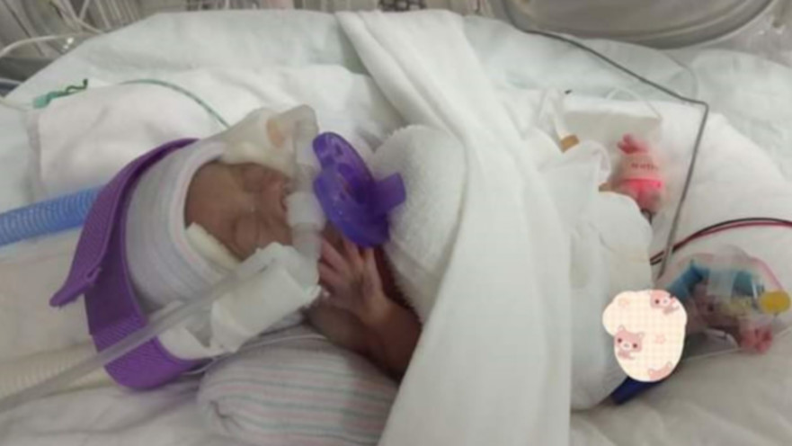 התינוקת הקטנה ביותר בעולם