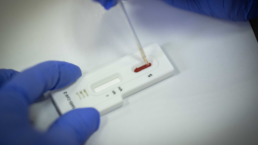 בדיקה סרולוגית