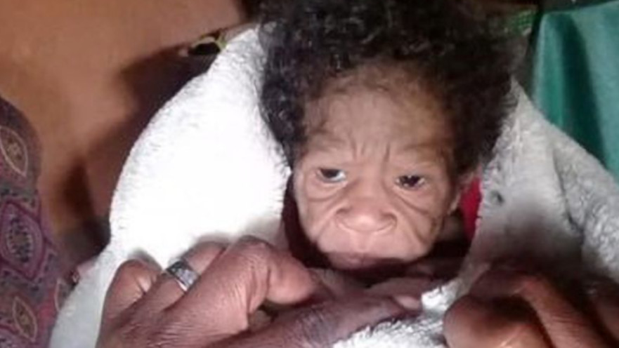 התינוקת "הזקנה"