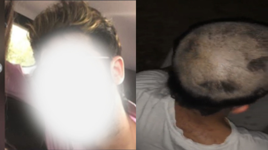 ראשו המגולח של המתלונן