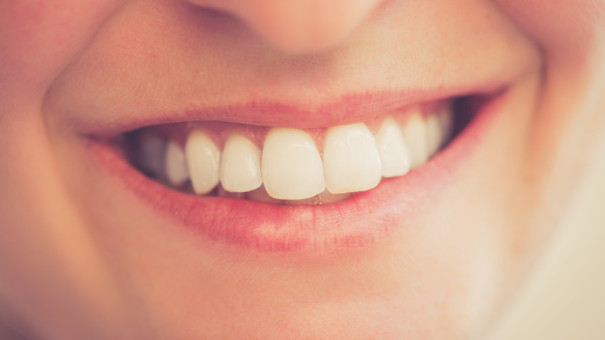 שיניים בריאות (אילוסטרציה)