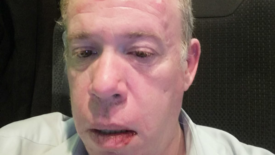 נהג האוטובוס שנפגע