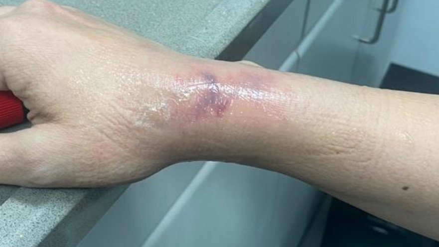 הפציעה של הרוקחת בפתח תקווה