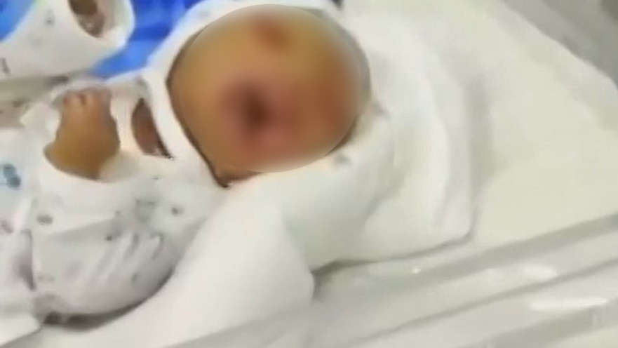 תינוק שהוריו אחים, נולד עם מומים קשים