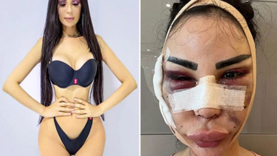 ג'ניפר פמפלונה, שילמה הון כדי להיראות כמו קים קרדשיאן, ועכשיו משלמת לא מעט כדי לחזור לפניה הטבעיות