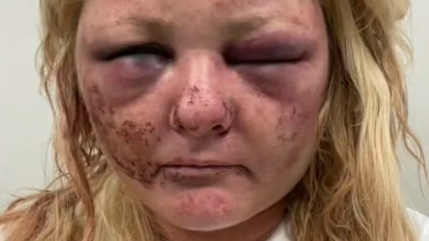 מריסה יאנג, ניסתה להכניע את התוקף שלה