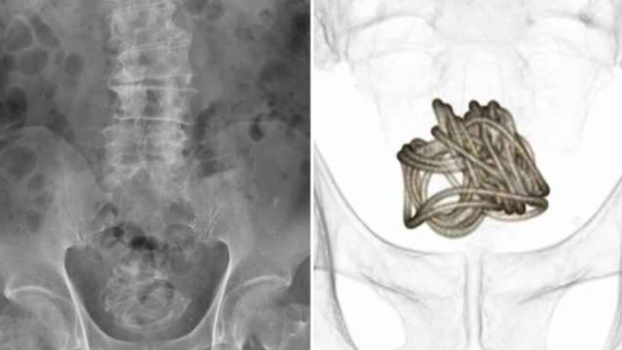 לא הסביר מדוע הוא עשה זאת