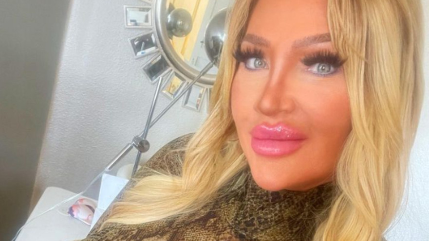 קול, מכורה לניתוחים פלסטיים