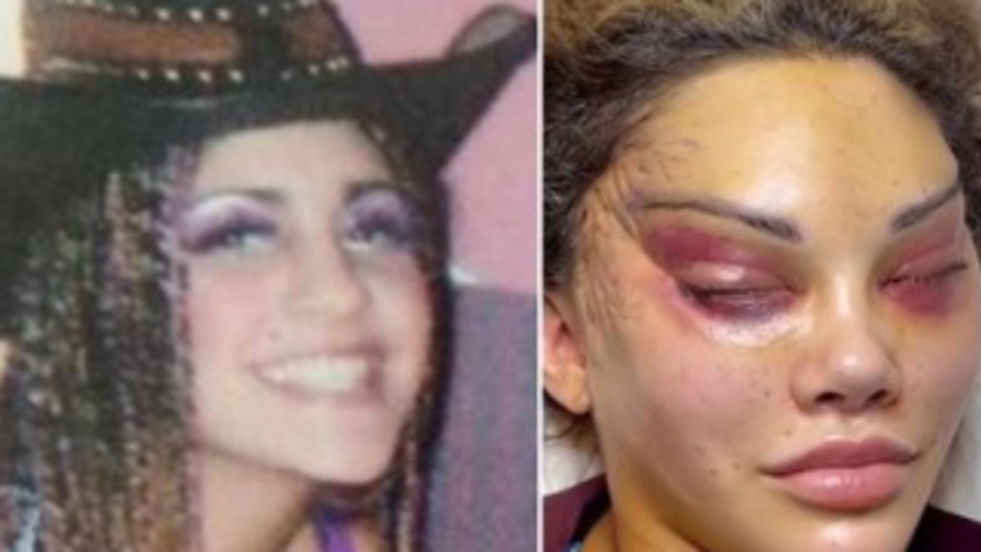 עברה מתיחת עיניים וכך היא נראית