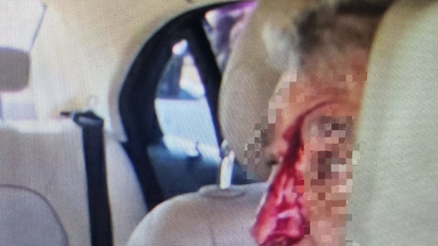 תקיפה חמורה בתל אביב 