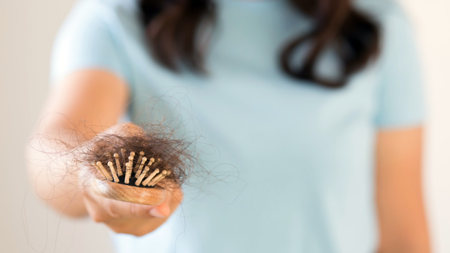 נשירת שיער, אילוסטרציה