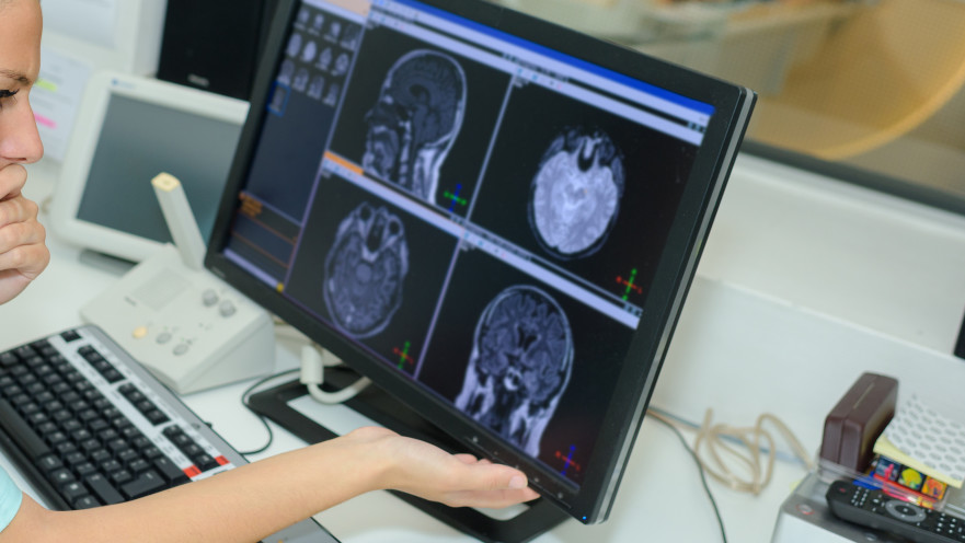 בדיקת CT, אילוסטרציה