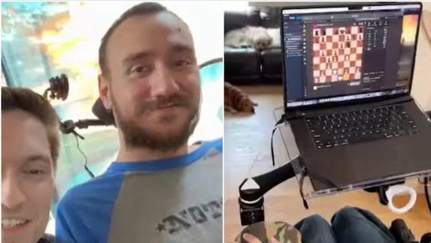 מושתל השבב המוחי הראשון 