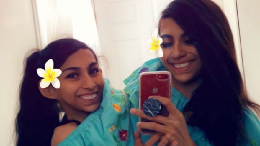 קרמן ולופיטה, התאומות הסיאמיות