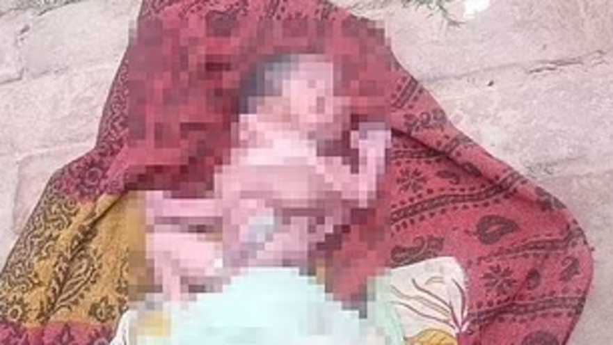 תינוק בהודו נולד עם שמונה גפיים ושתי פנים