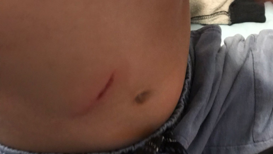 הילד שנפגע בקטטה בבית ספר