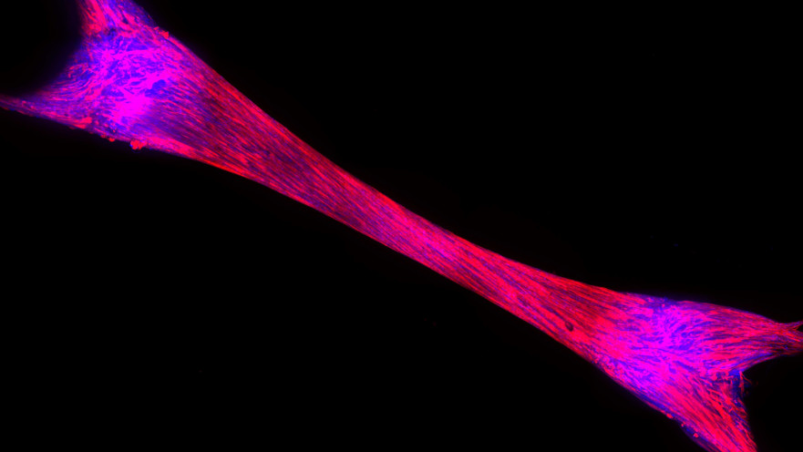 רקמת שריר שגודלה על ידי ProFuse במעבדה