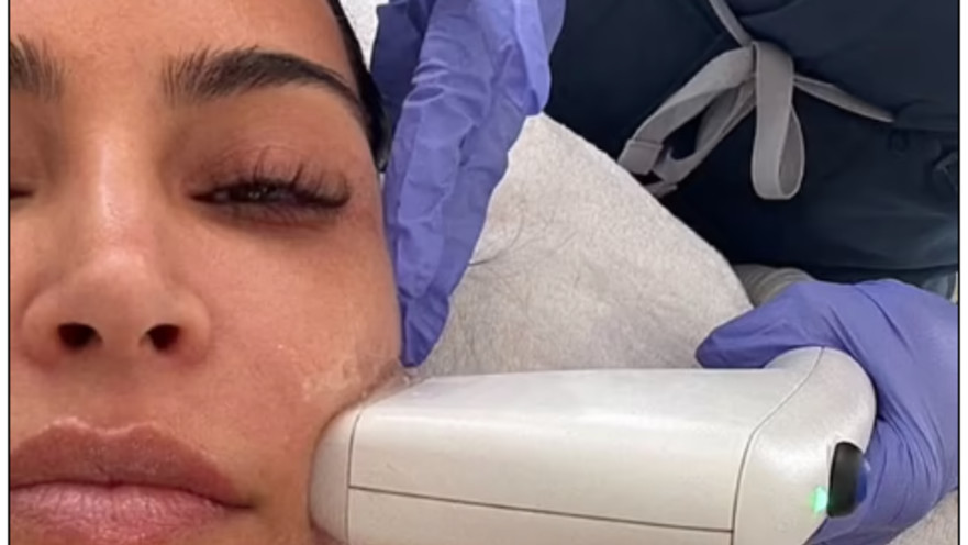 קים קרדישן בטיפול SOFWAVE 