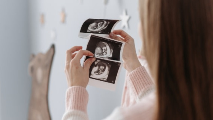 מלווה אותך בכל שבוע: אפליקציית פורטי תהפוך את ההריון לחוויה
