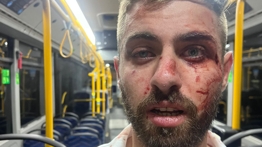 נהג אוטובוס שהותקף בירושלים