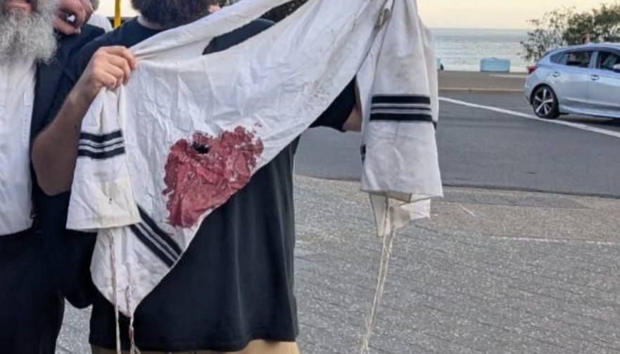 ציצית מוכתמת בדם באוסטרליה (צילום: רשתות חברתיות)