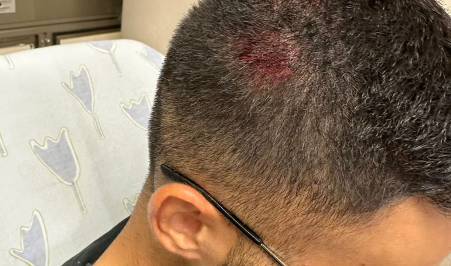 במהלך פיזור המפגינים באיילון: שוטר נפצע באורח קל בראשו