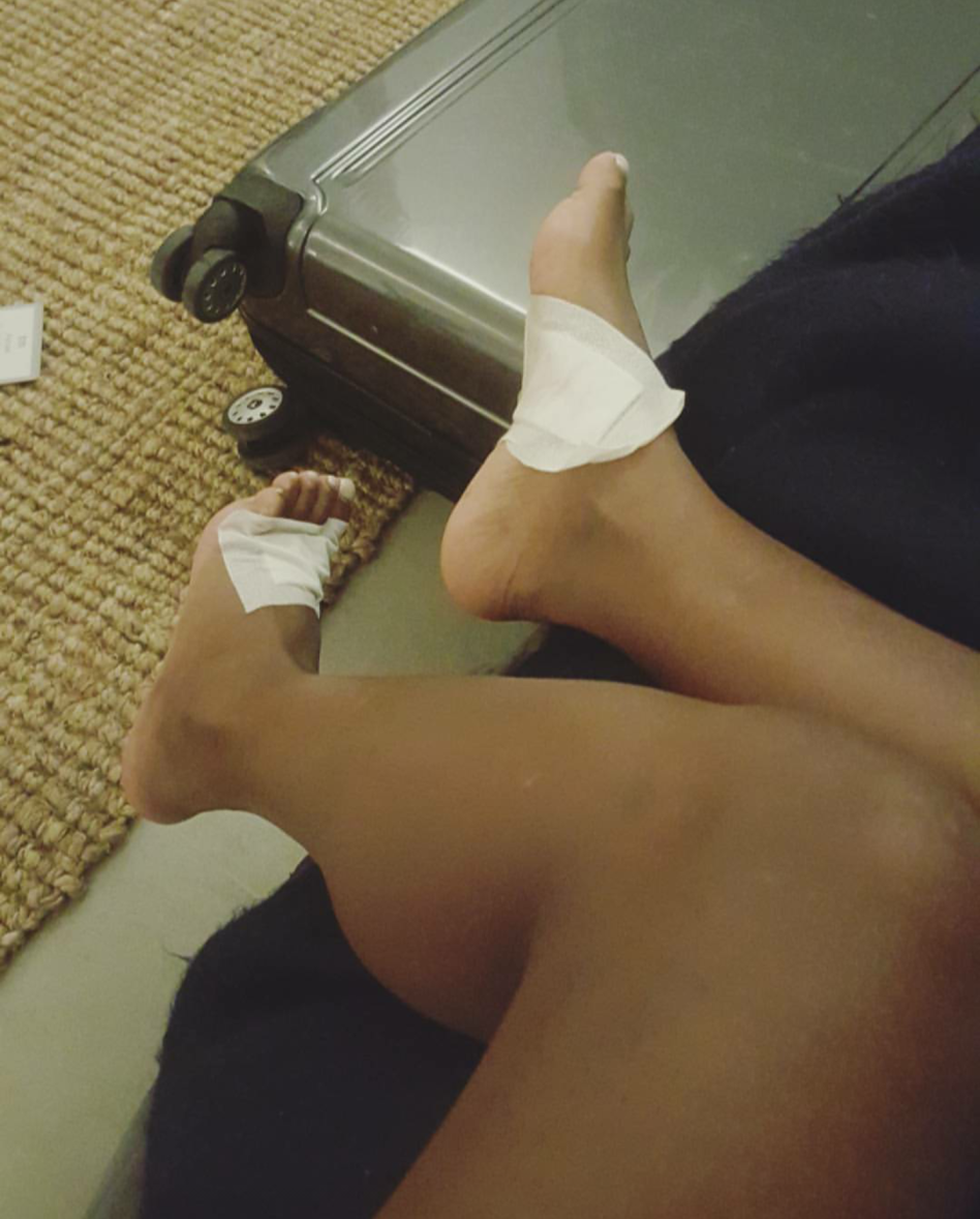 זמן פציעות. טיטי איינאו (צילום: צילום מסך מתוך אינסטגרם)