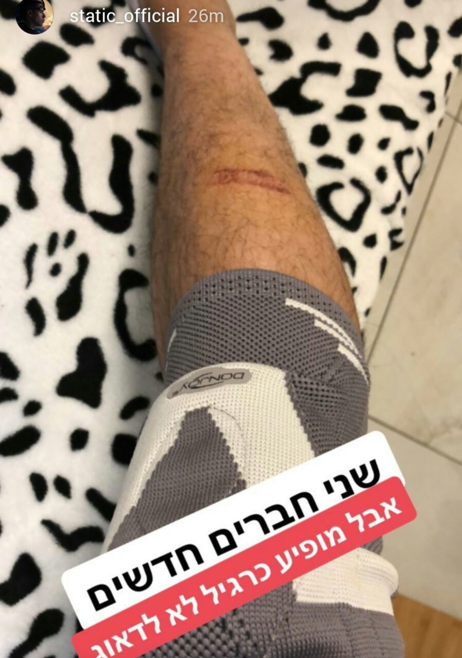 אמאלה. סטטיק (צילום: אינסטגרם)