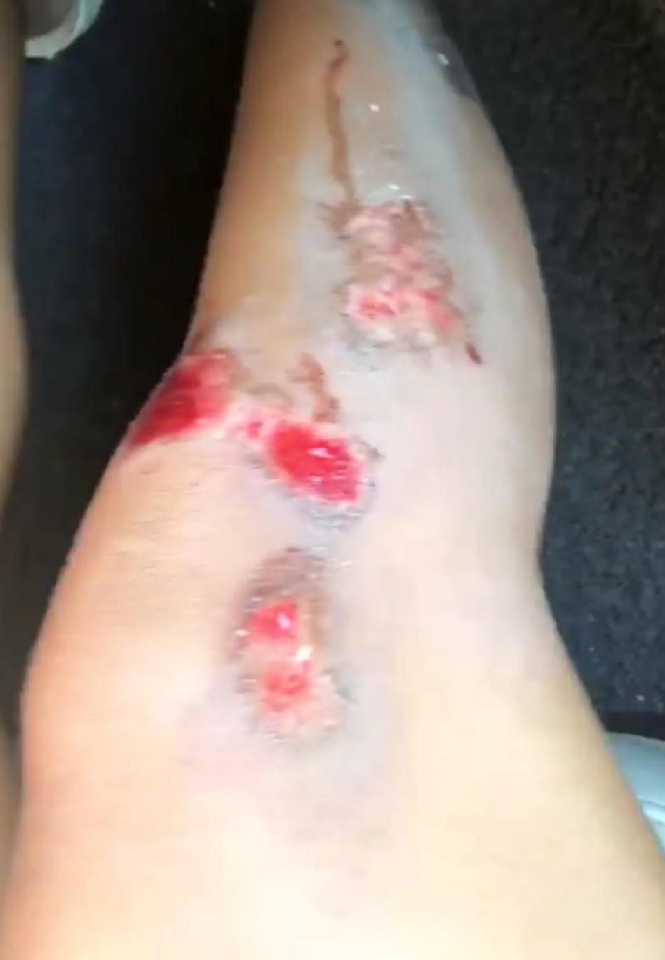 לא רק נראה כואב