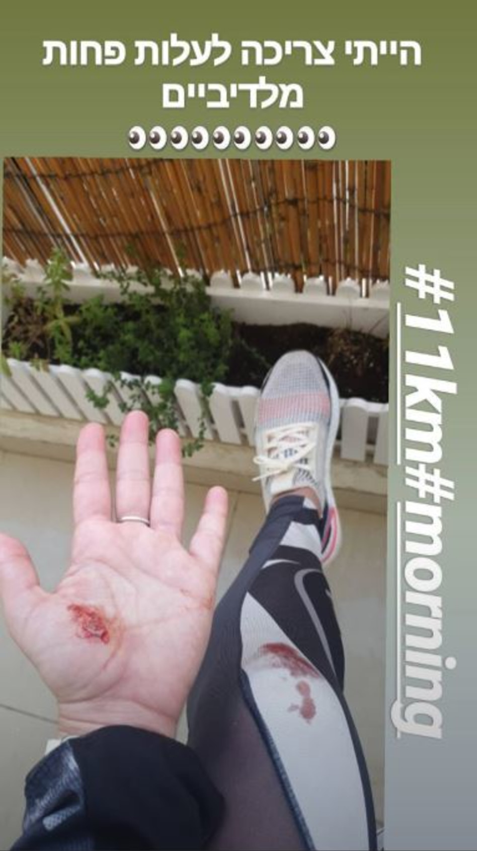 לא נעים. אנה ארונוב אחרי הנפילה (צילום: אינסטגרם)