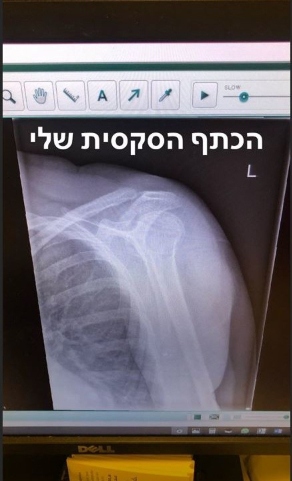 (צילום: אינסטגרם)