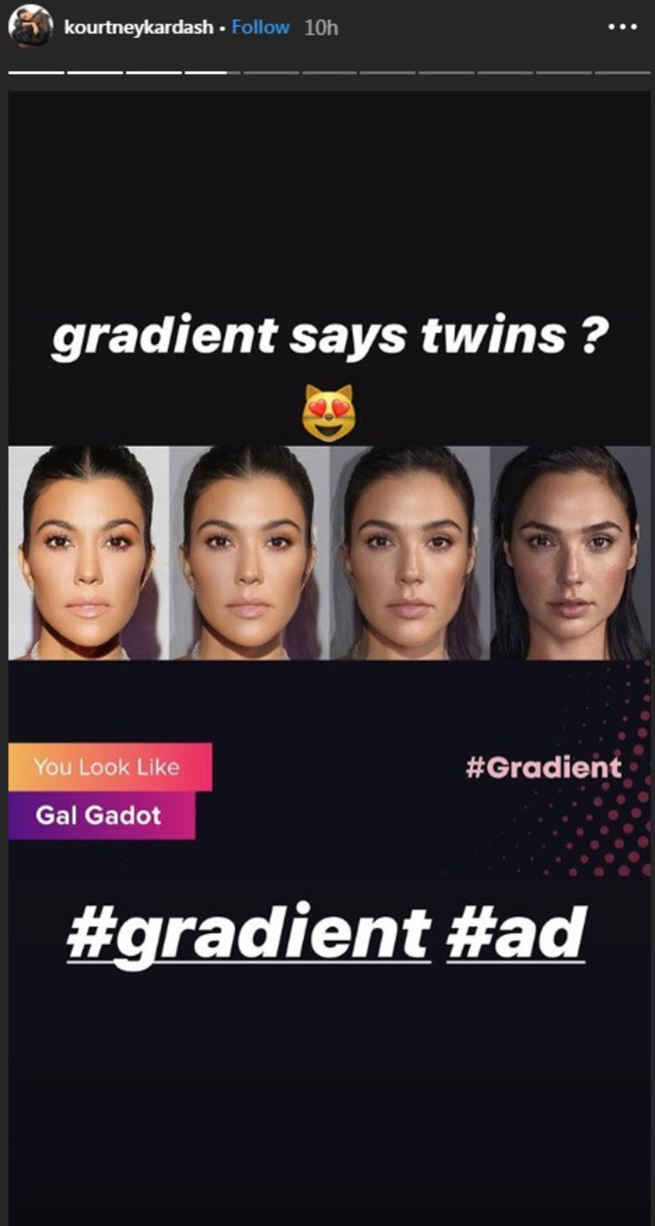 ההשוואה המפתיעה (צילום: אינסטגרם)