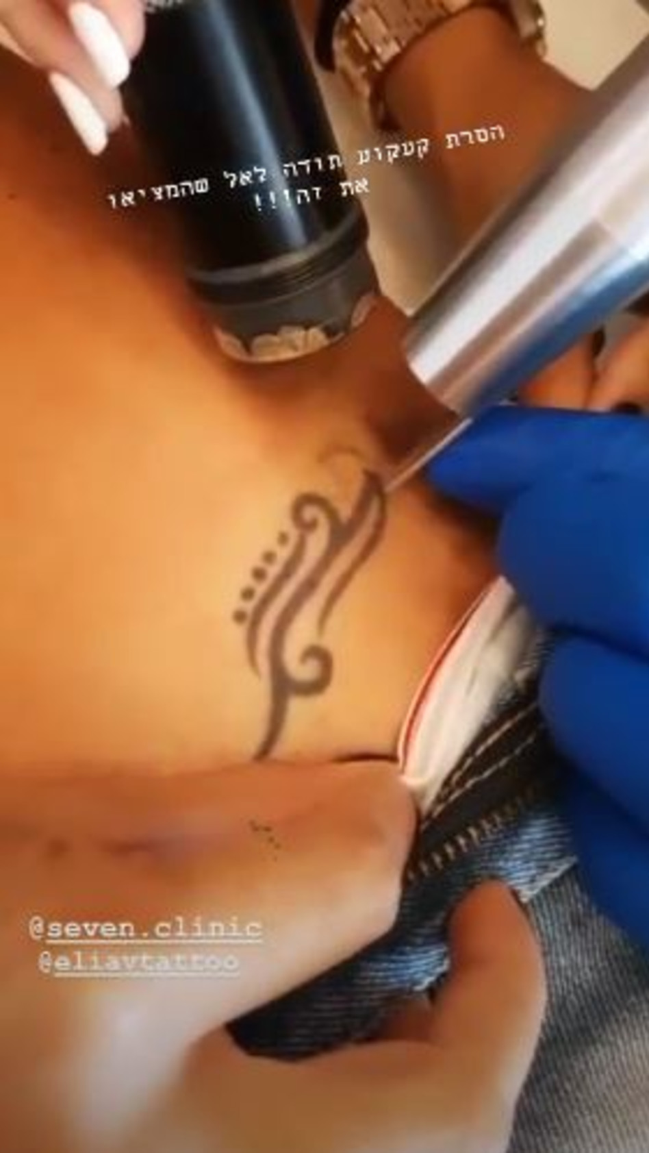 הסירה את הקעקוע (צילום: אינסטגרם)