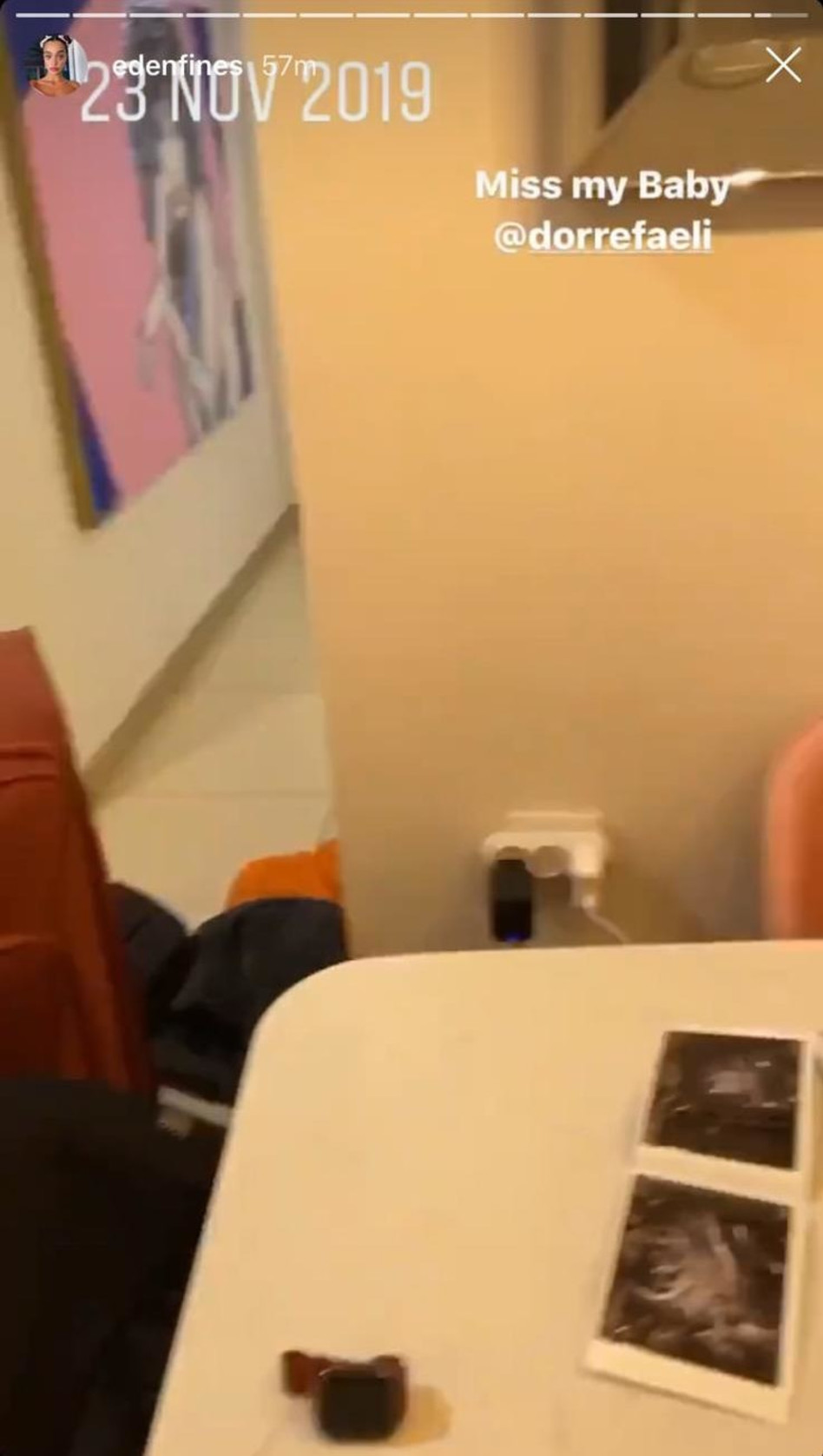 צילום האולטרסאונד שעדן פינס שיתפה (צילום: אינסטגרם)