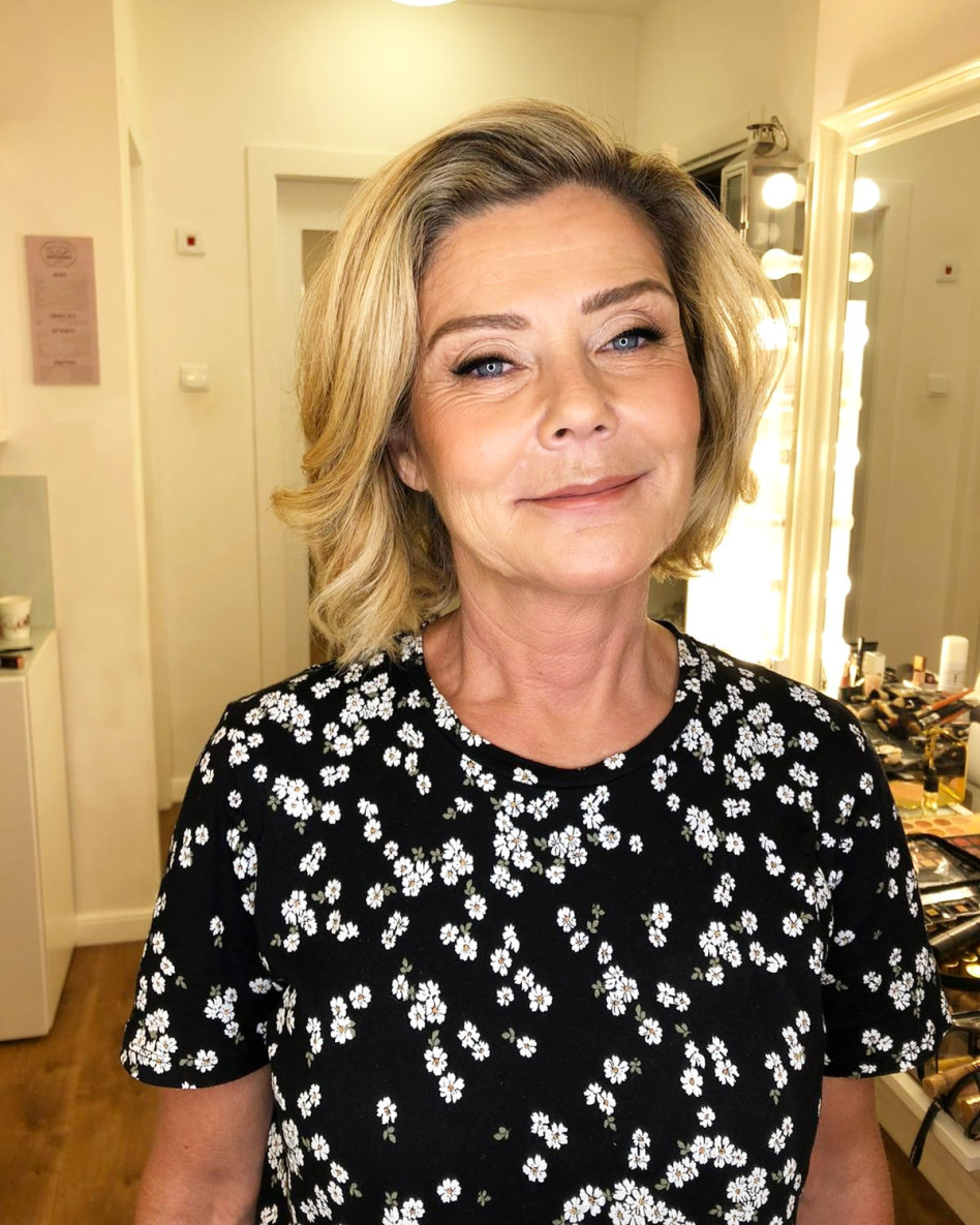 תתחדשי! דובי עמירה אחרי ההזרקות (צילום: ענת מוסברג)