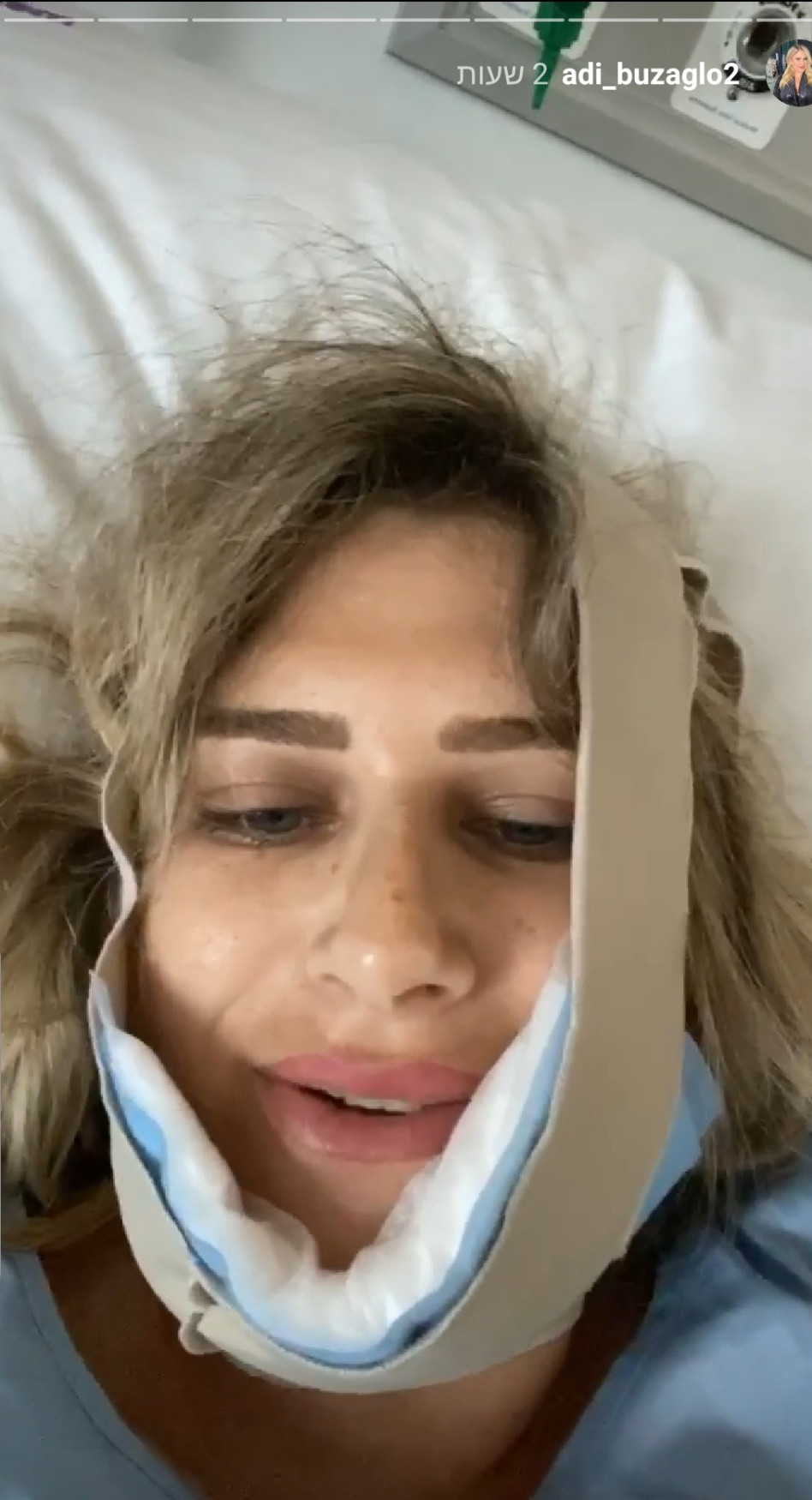 עדי בוזגלו מתאוששת מהניתוח (צילום: אינסטגרם)