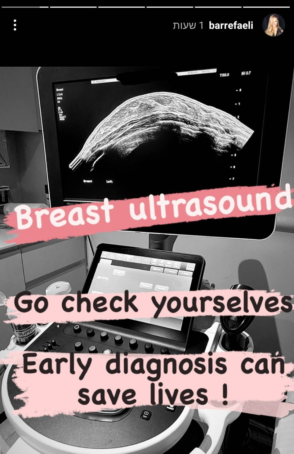 בר רפאלי בבדיקה (צילום: צילום מסך אינסטגרם)