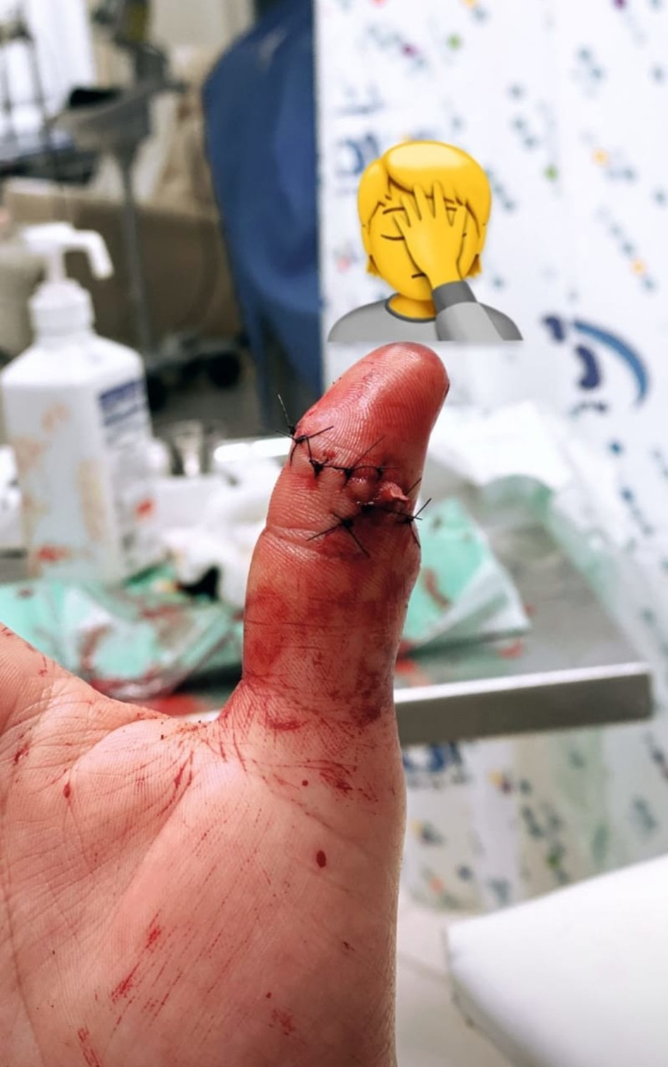 מייקל לואיס (צילום: צילום מסך אינסטגרם)