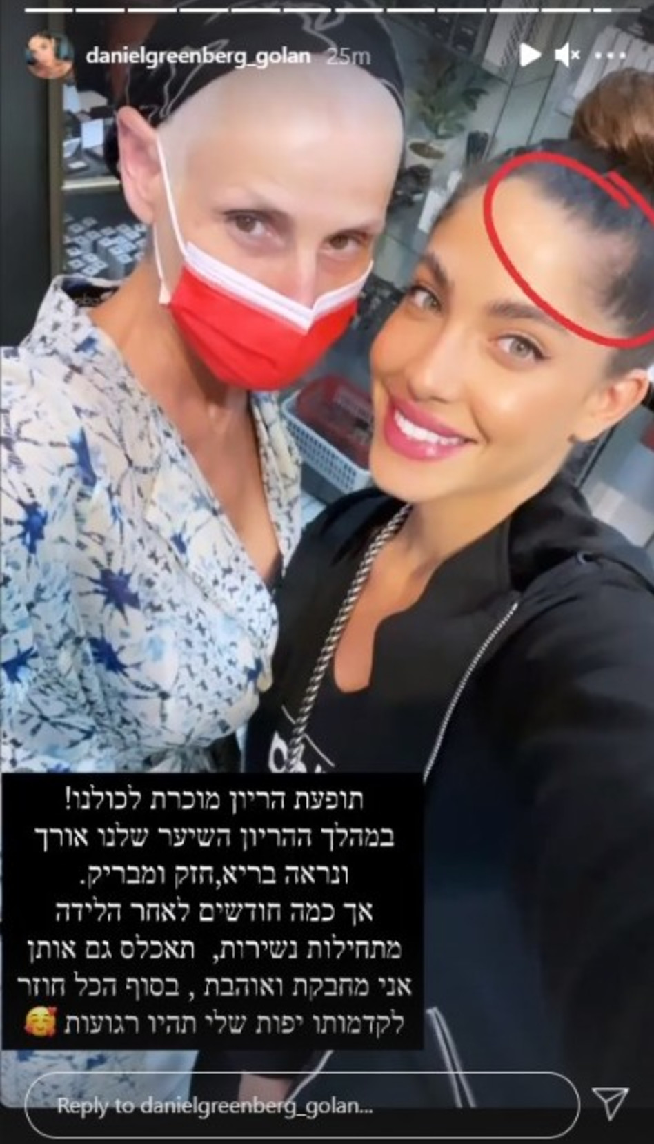 דניאל גרינברג חושפת צד פחות יפה של הלידה | TMI