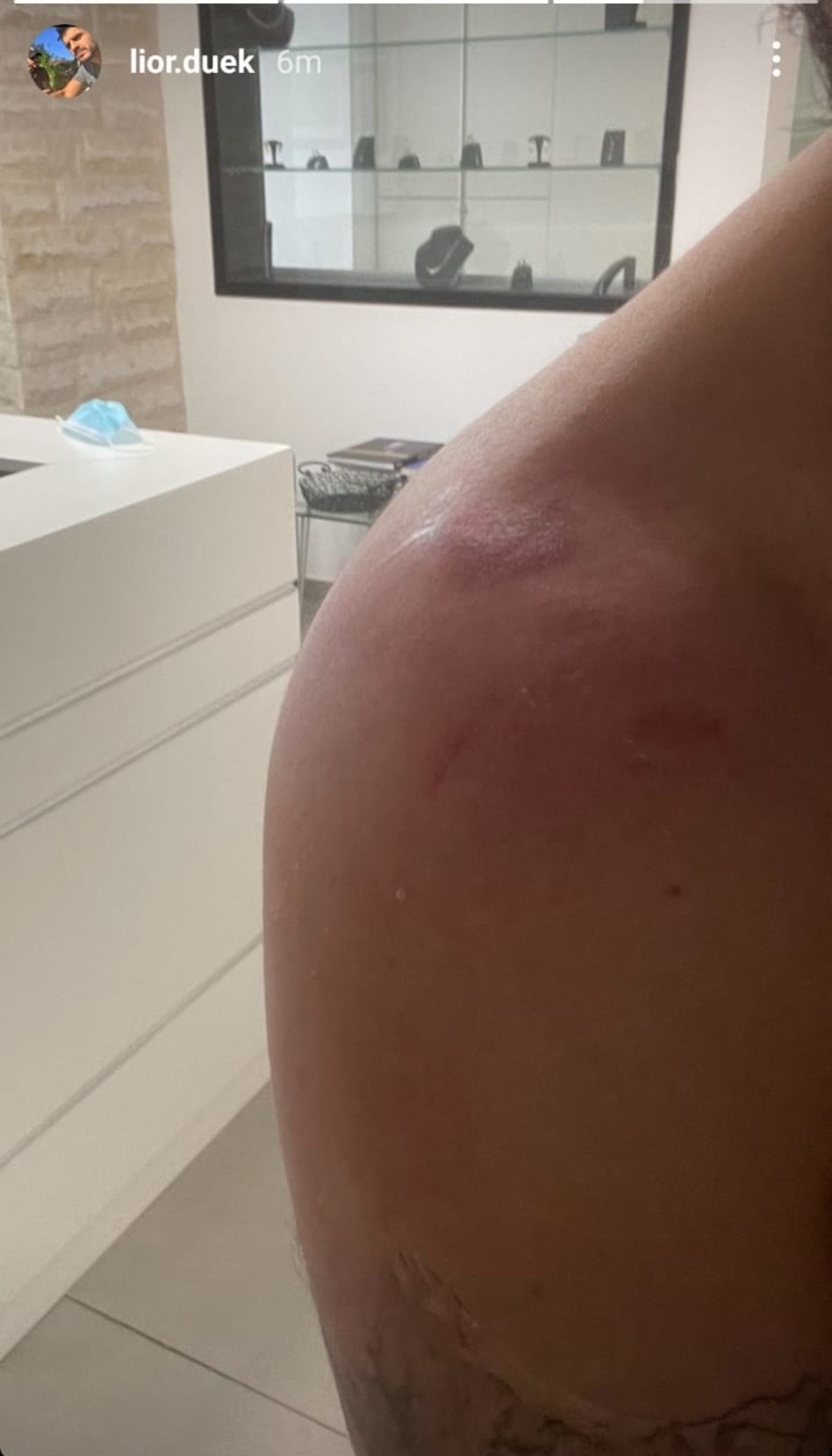 ליאור דואק (צילום: צילום מסך אינסטגרם)