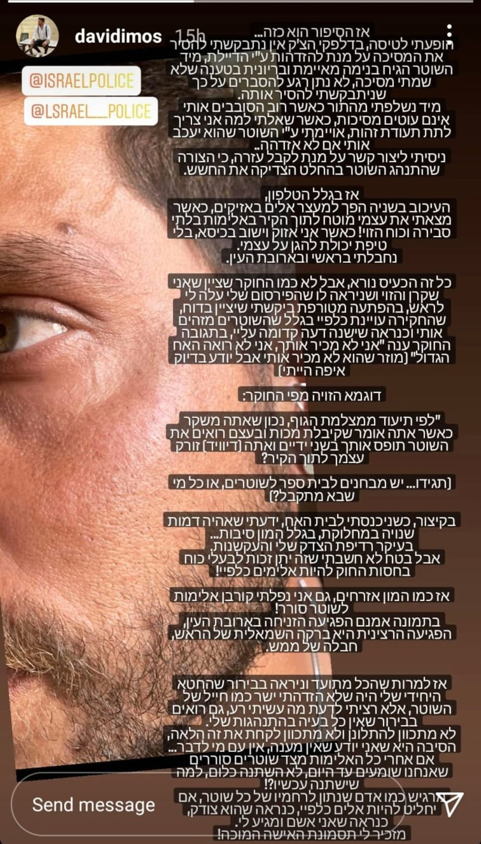 דיוויד דימוס, האח הגדול (צילום: צילום מסך אינסטגרם)