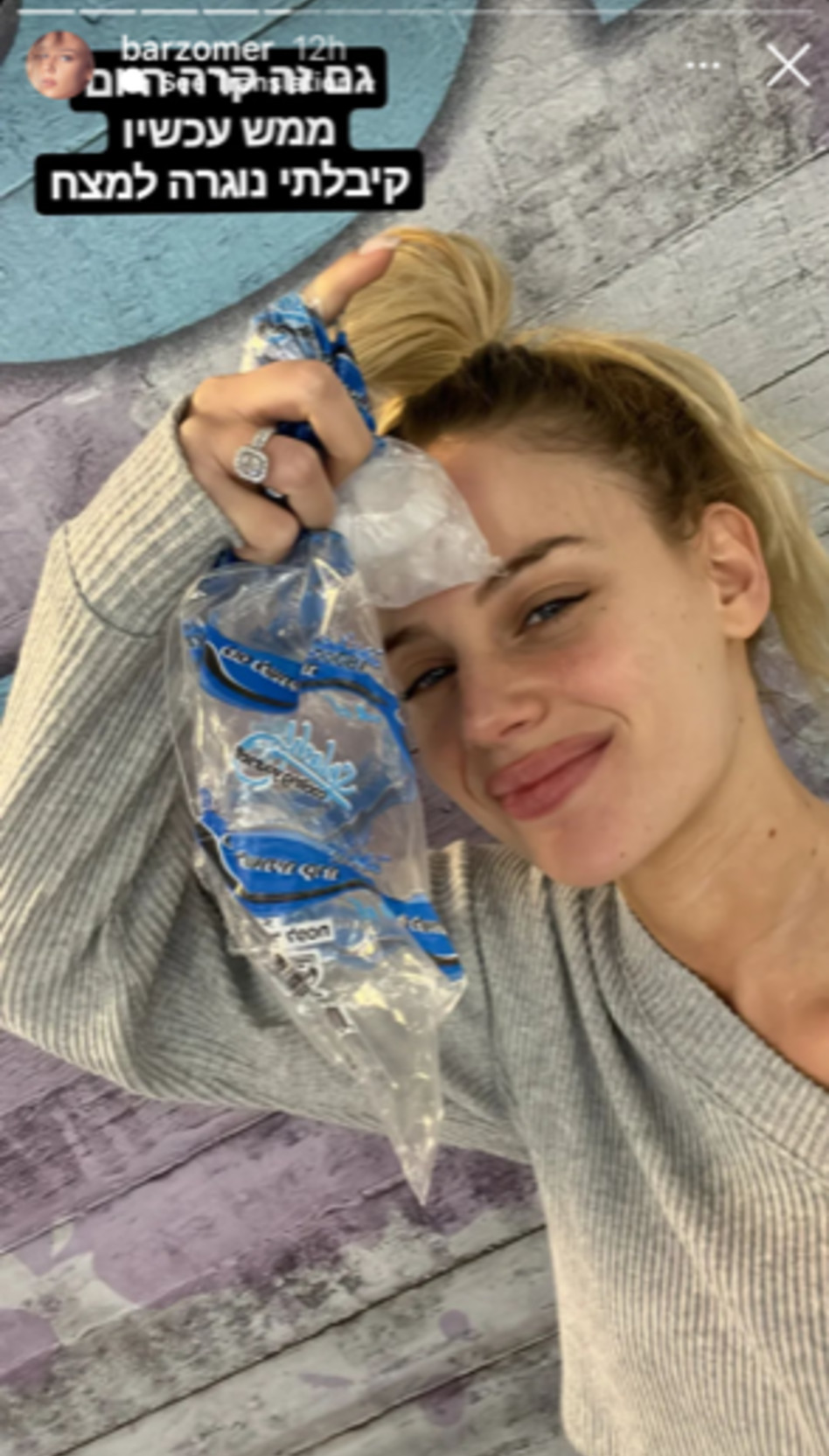 הפציעה של בר זומר (צילום: צילום מסך אינסטגרם)