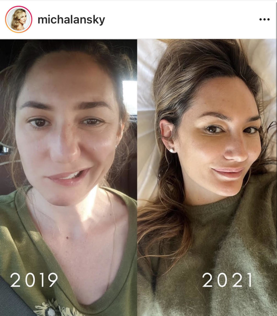 הפוסט של מיכל אנסקי (צילום: צילום מסך אינסטגרם)