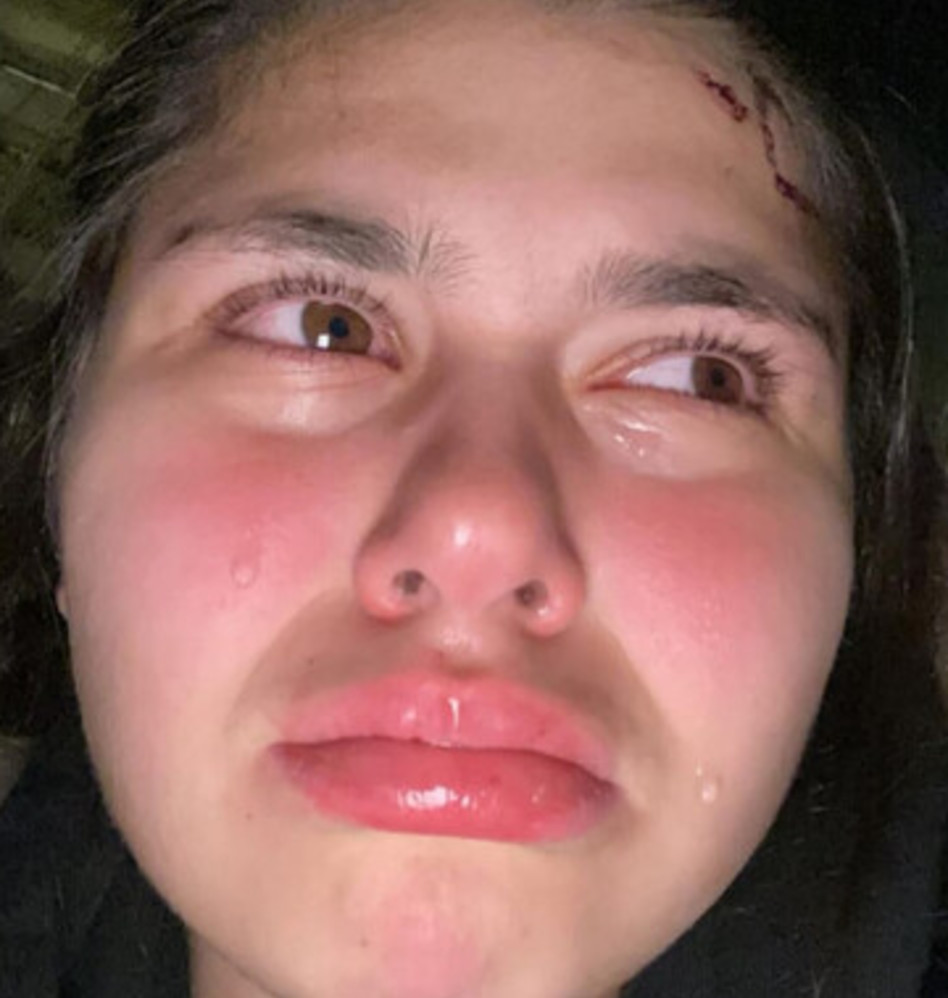 טום טלקר (צילום: צילום מסך אינסטגרם)