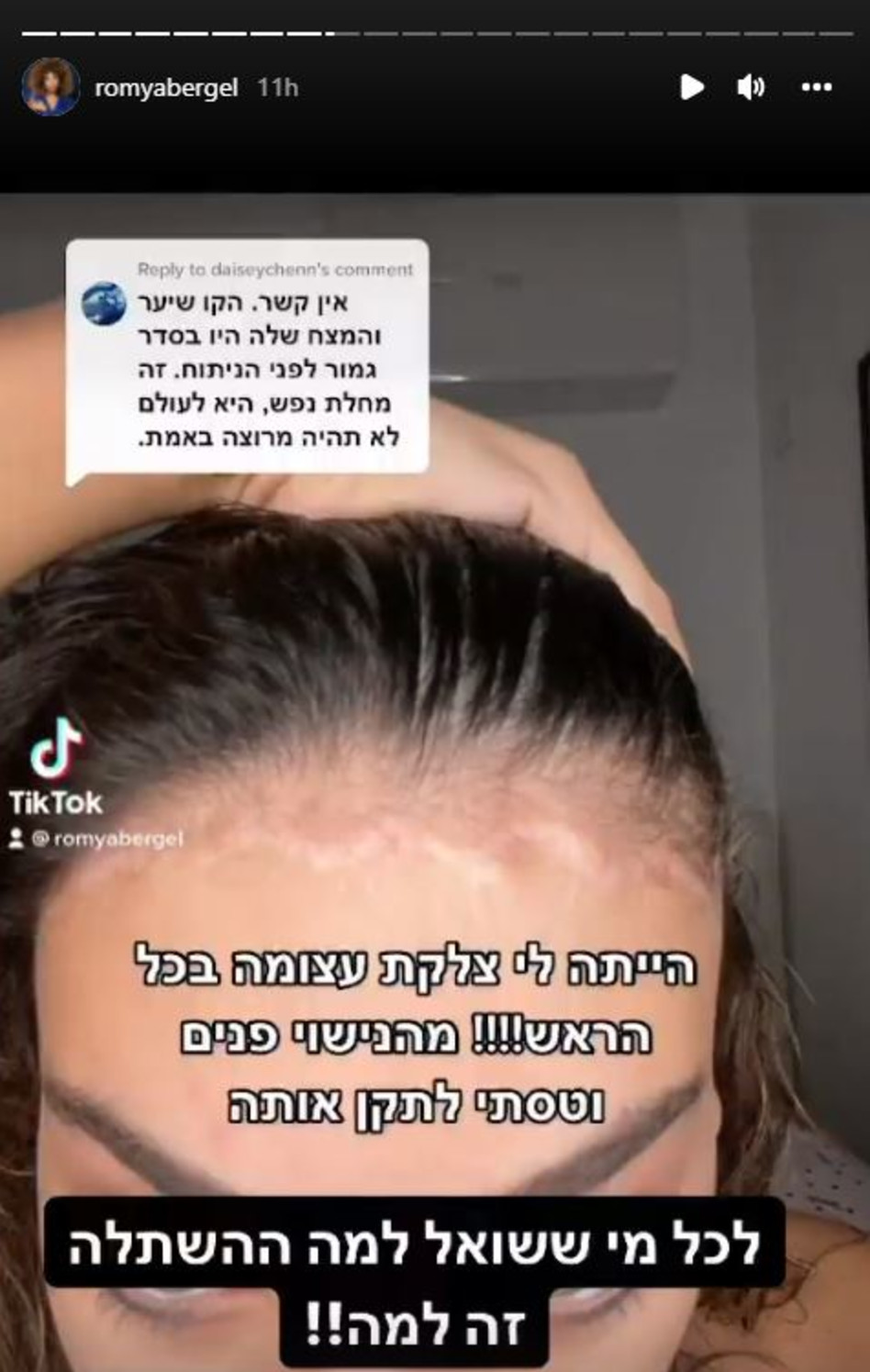רומי אברג'יל (צילום: צילום מסך אינסטגרם)
