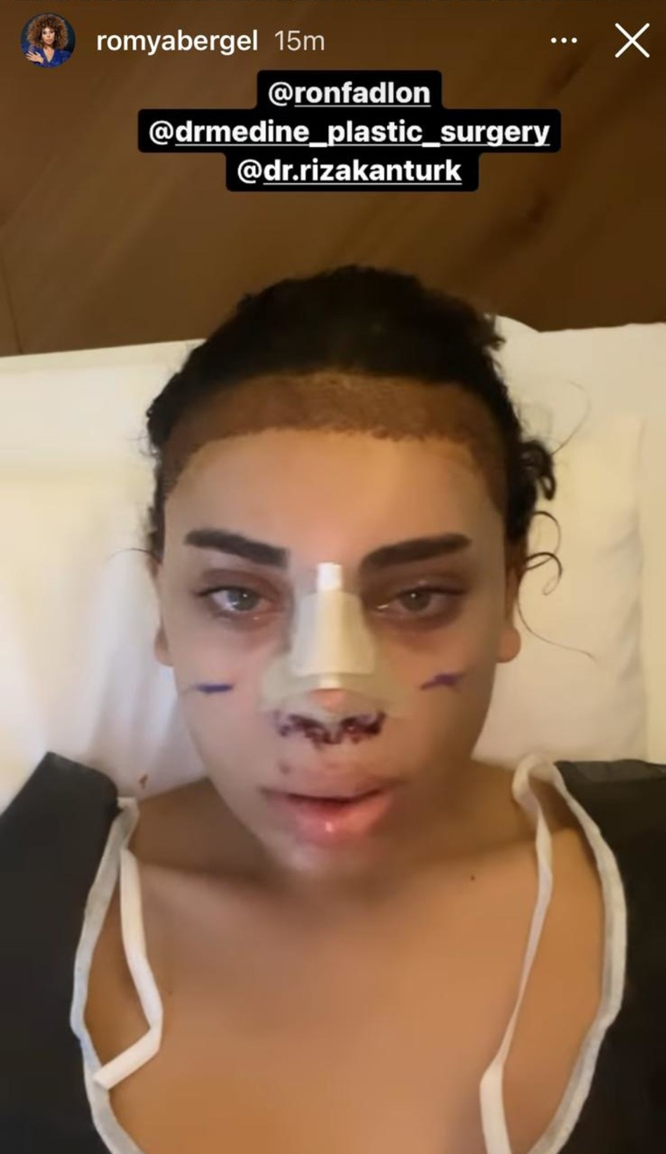 רומי אברג'יל (צילום: צילום מסך אינסטגרם)