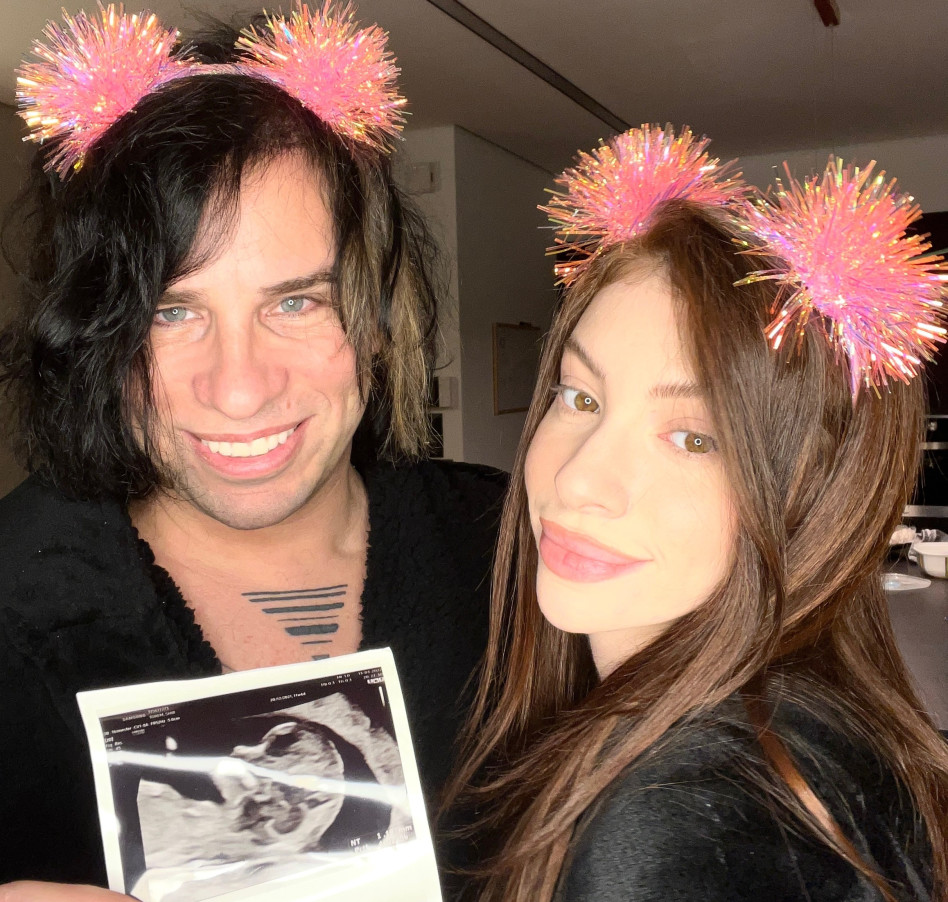 סקאזי, שיר טורם (צילום: יח''צ)