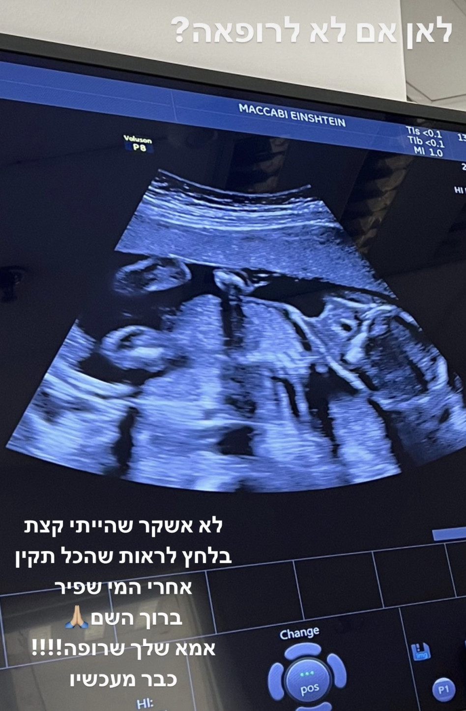 בן או בת? קורין גדעון (צילום: צילום מסך אינסטגרם)