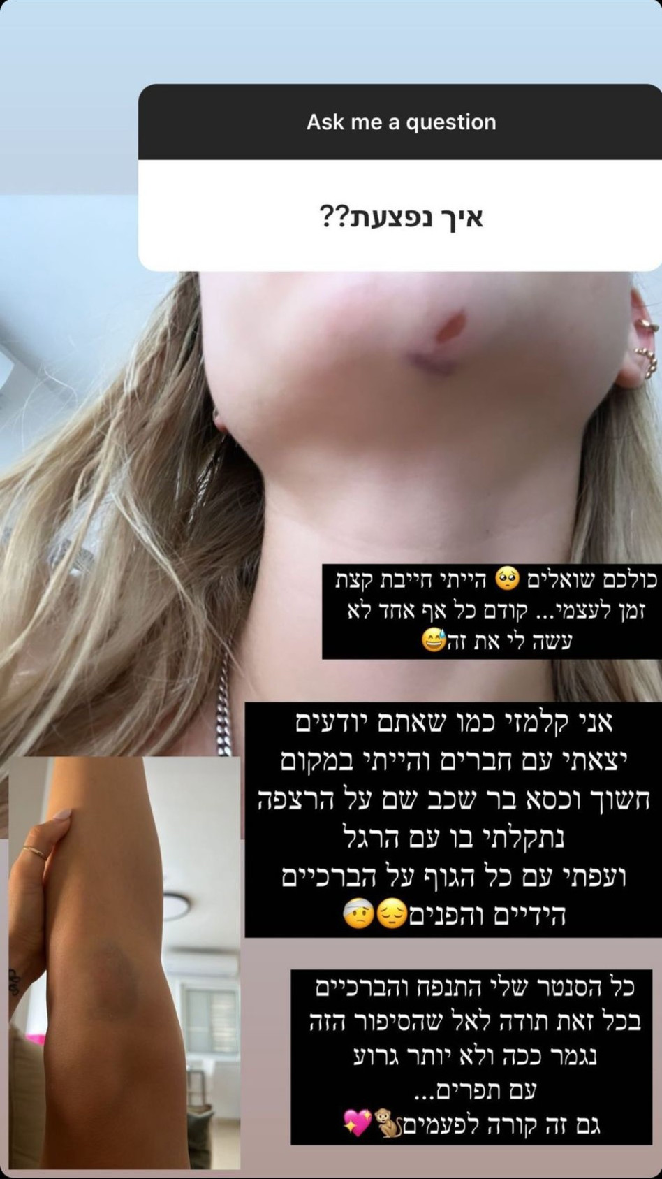 אלה איילון (צילום: צילום מסך אינסטגרם)